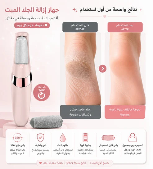 Electric Foot Callus Remover