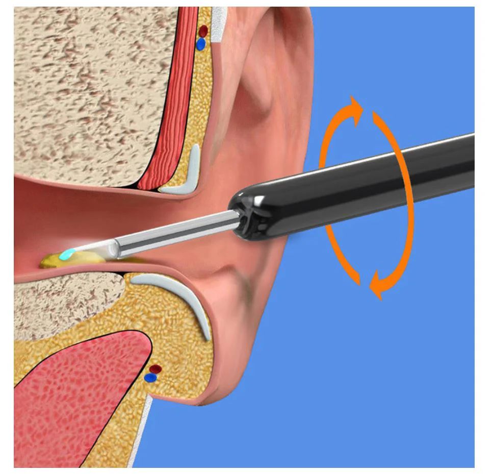 Electric Ear Wax Removal Tool – Gentle Ear Cleaning Device with LED Light