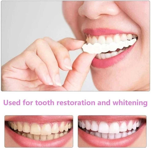 Snap in Teeth for Men and Women | الأسنان التركيب الفوري للرجال والنساء